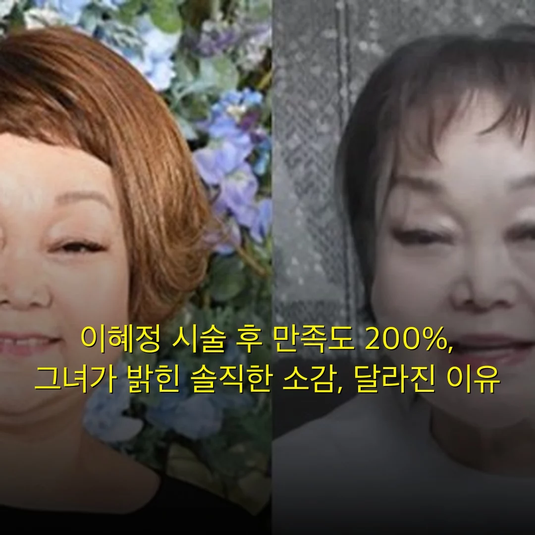 이혜정 시술 후 만족도 200%, 그녀가 밝힌 솔직한 소감, 달라진 이유